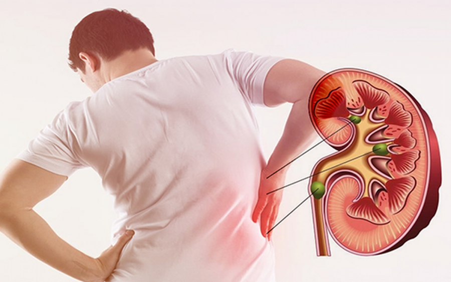 8 loai rau la be chua axit oxalic, an vao than 