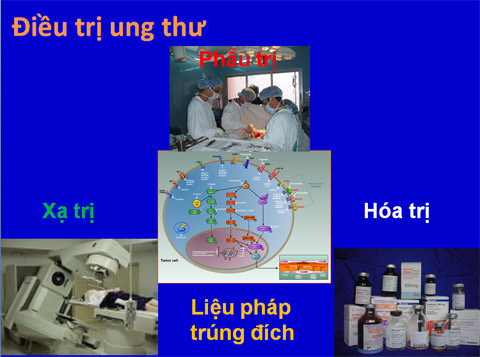 Các phương pháp chính trị UTĐTT.