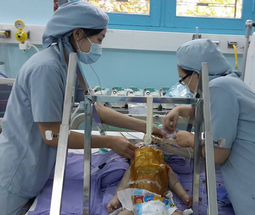 Điều dưỡng đang bơm sữa cho Phi Phụng.