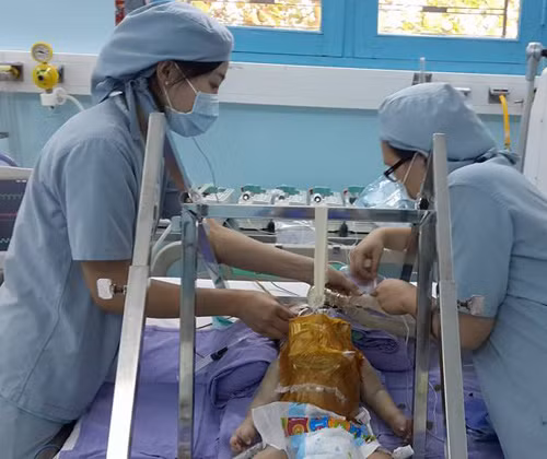 Điều dưỡng đang bơm sữa cho Phi Phụng.