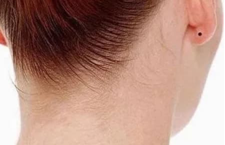 br/> 3. Có nốt ruồi sau tai: Người có nốt ruồi sau tai có nhiều người cao thượng trong cuộc sống, khi họ gặp khó khăn, nguy hiểm trong cuộc sống sẽ có thể kiếm tiền, giữ tiền và có rất nhiều tiền tiết kiệm trong đời.