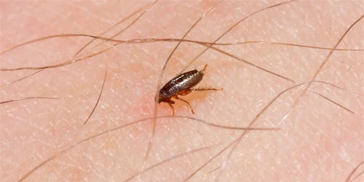 Top 10 loai con trung nguy hiem nhat the gioi: So 1 bi ghet nhat-Hinh-2