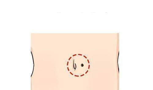 Nhung nguoi co not ruoi o day la 'phu ong phu quy', giau bat chap-Hinh-2