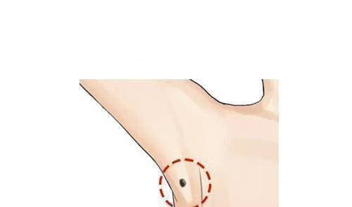 Nhung nguoi co not ruoi o day la 'phu ong phu quy', giau bat chap