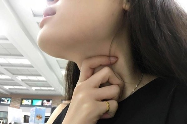 Bac si canh bao cach che bien rau cu lam tang nguy co ung thu-Hinh-3