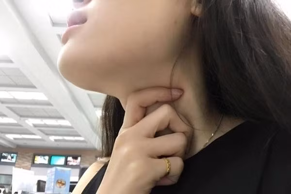 Bac si canh bao cach che bien rau cu lam tang nguy co ung thu-Hinh-3