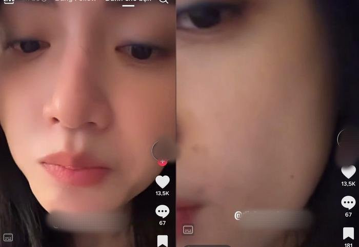 Huong Giang tu tin khoe mat moc tren song livestream