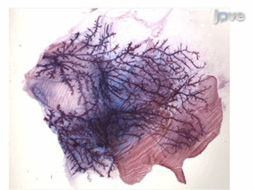 Tuyến sữa. Ảnh MNT