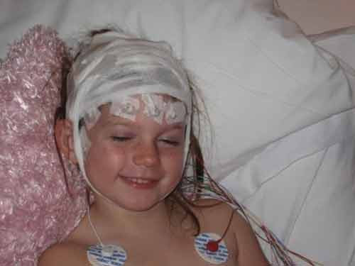 Các bác sĩ cũng chọn phương án mạo hiểm là phẫu thuật cắt nửa bên não với tỷ lệ sống hết sức mong manh. Tuy nhiên kết quả thật bất ngờ, phương pháp này không những đã cứu sống bé Jessie, mà còn cho em những hy vọng mới về cuộc sống. Sau ca phẫu thuật, Jessie đã có những dấu hiệu hồi phục tuyệt vời. Cô bé đã có thể đi lại trong phòng tập, dưới sự hướng dẫn của các bác sĩ.