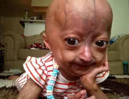 Fanpage của Adalie Rose có tới gần 6 triệu lượt người theo dõi.