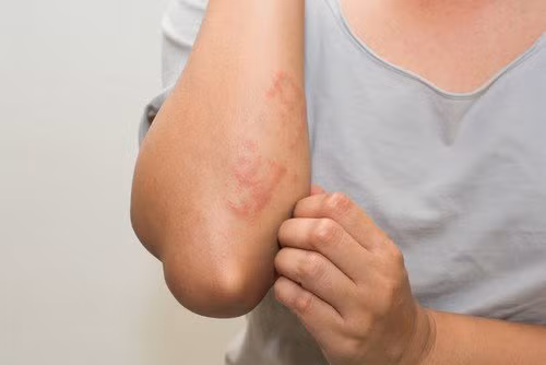 Bi ngua nhung cho nay nguy co benh tat, cho dai coi thuong-Hinh-2