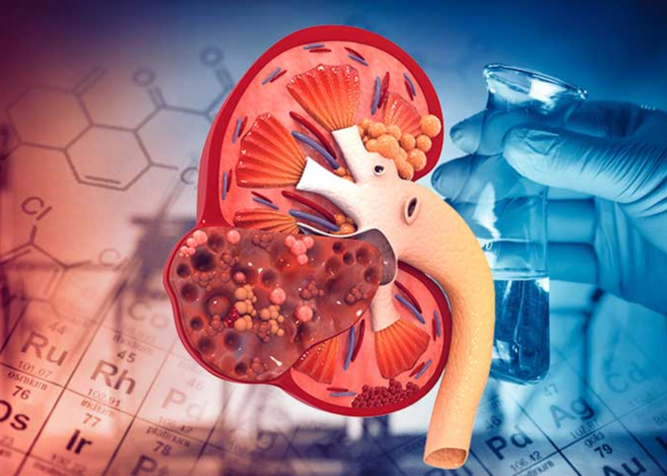 Thoi quen xau hang ngay de dan den suy than