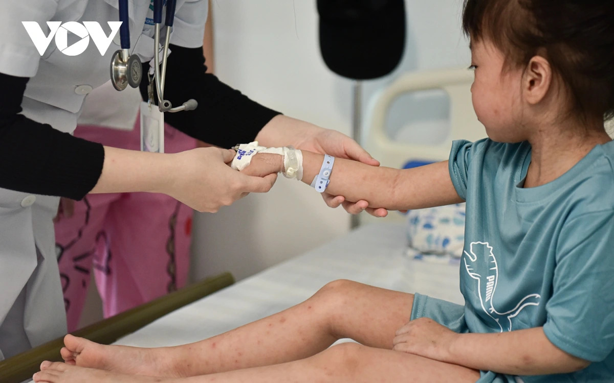 Con gái chị Cù Thị Hương (Thanh Oai) đang điều trị sởi tại Bệnh viện Nhi Hà Nội. Mặc dù trong độ tuổi tiêm vaccine phòng sởi, nhưng gia đình chưa kịp cho bé đi tiêm.