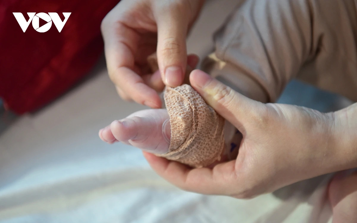 Cộng dồn năm 2025, Hà Nội ghi nhận 1.247 trường hợp mắc sởi tại 30/30 quận, huyện, thị xã, 1 trường hợp tử vong, tăng so với cùng kỳ 2024.