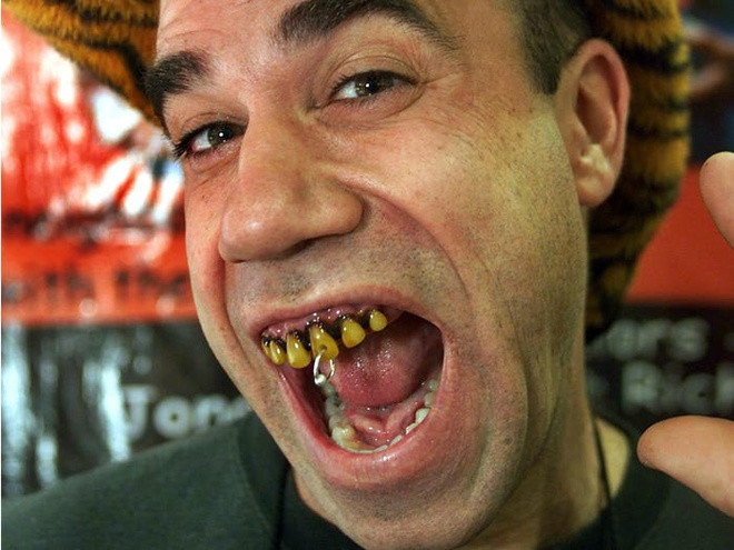 Bộ răng kỳ dị có tên Billy Bob được sáng tạo vào năm 1993, và nay có mặt tại 95% các quốc gia trên thế giới. Năm 2015, Bloomberg ước tính có tổng cộng 15 triệu bộ răng kỳ quái này đã được bán. Ảnh: Getty.