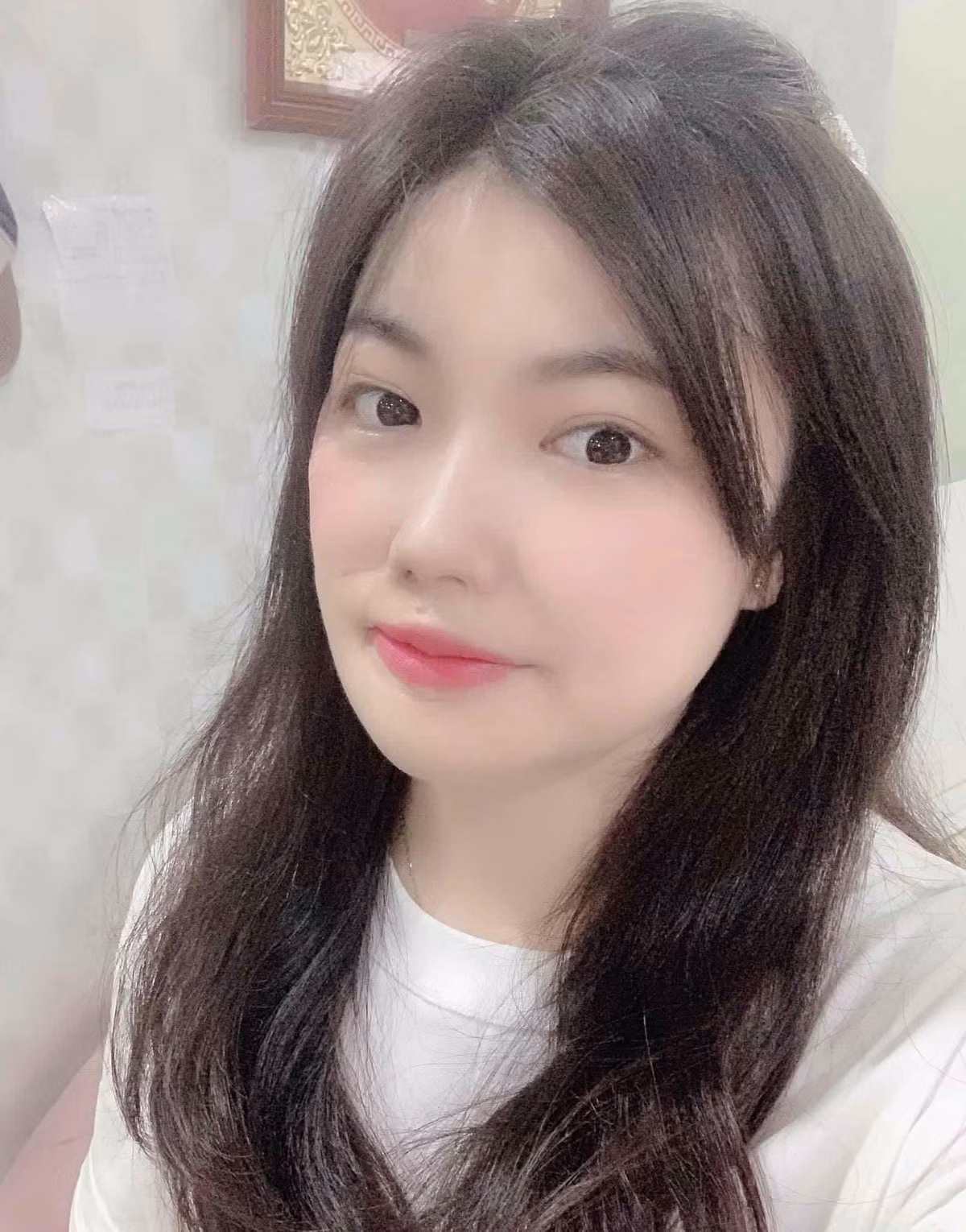 Roi nuoc mat hanh trinh dau don lay lai dien mao cua co gai bi tat axit