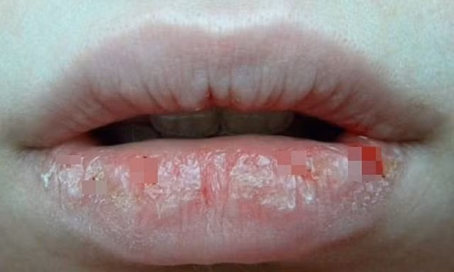 Guong mat xuat hien 9 dau hieu nay suc khoe dang bao dong