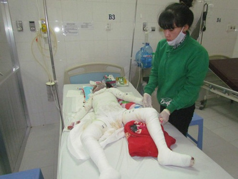 Cháu Thủy đang nguy kịch vì bị cháy toàn thân.