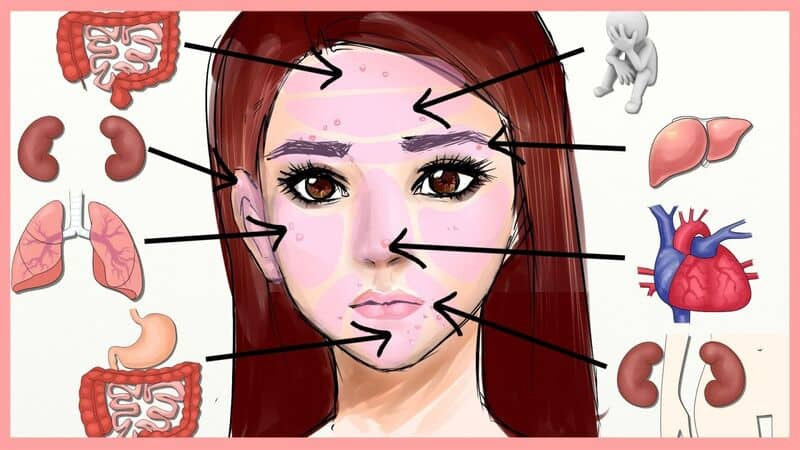 Vị trí mọc mụn trên mặt cảnh báo dấu hiệu sức khỏe đang gặp vấn đề bất thường cần kiểm tra ngay Vi tri moc mun tren mat canh bao dau hieu suc khoe dang gap van de bat thuong can kiem tra ngay