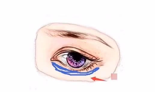 br/> Bờ mi dưới to và đen: Xét về mặt, mí mắt dưới là cung con cái, đại diện cho tài lộc, phúc đức của một người,… mí mắt dưới đầy đặn và hơi ngả vàng có nghĩa là đường tài lộc lớn mạnh, gặp nhiều may mắn. 