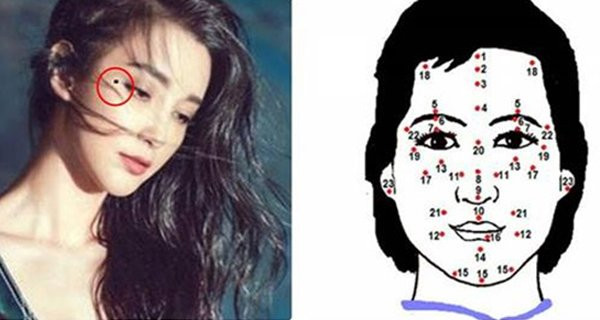 Not ruoi vuong tuong tu 9 kiep moi co, cho tay di keo phuc loc bay bien het