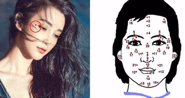 Not ruoi vuong tuong tu 9 kiep moi co, cho tay di keo phuc loc bay bien het