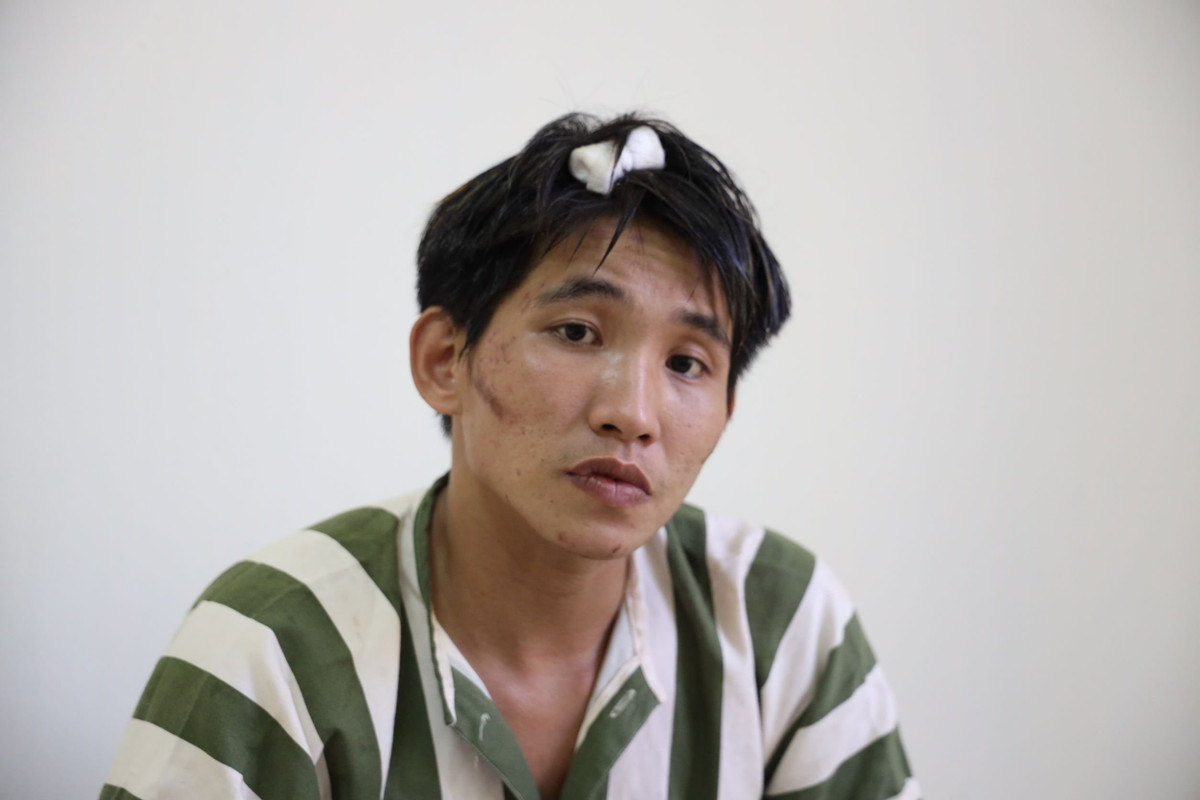 Loi thu toi cua nghich tu sat hai da man me ruot