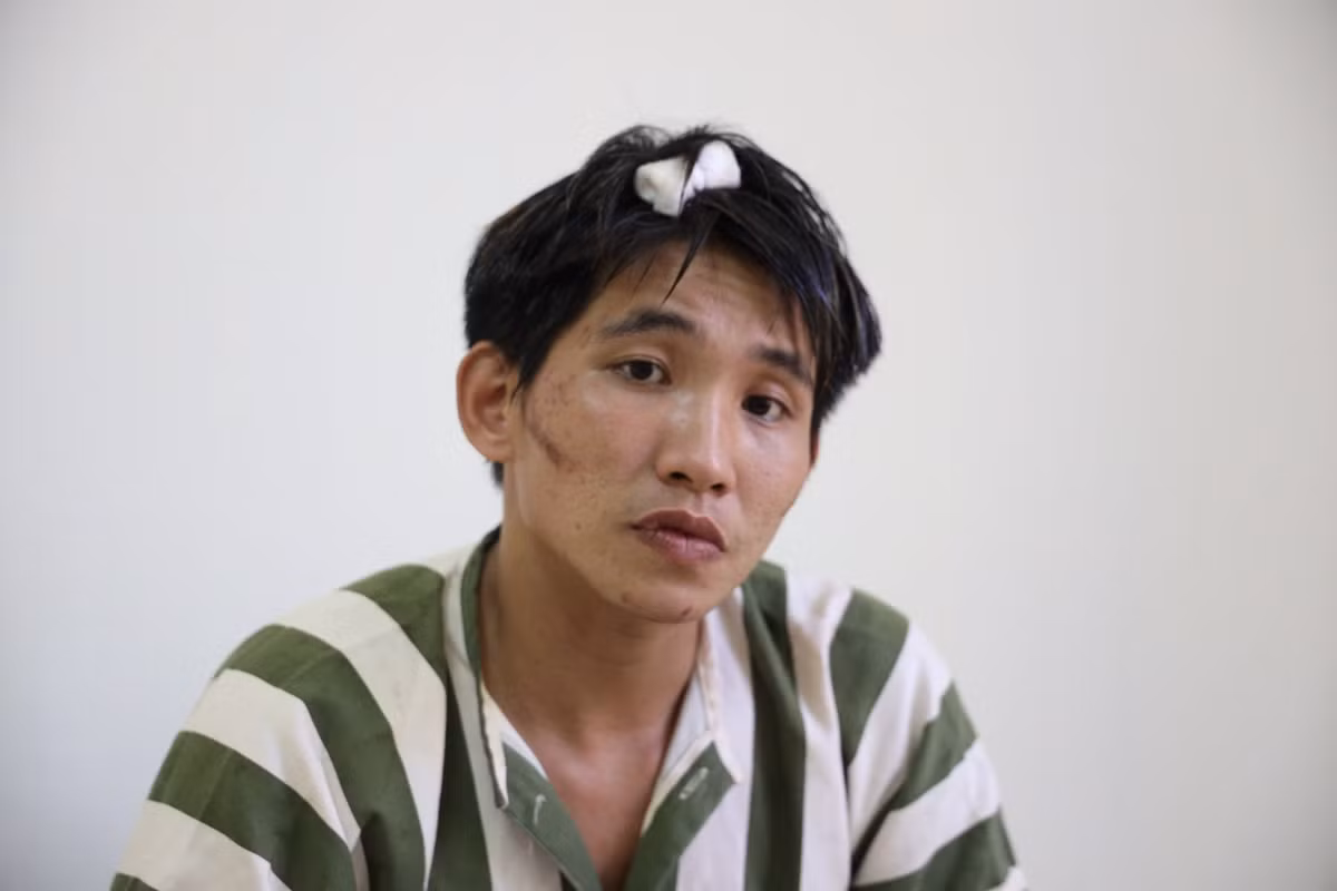 Loi thu toi cua nghich tu sat hai da man me ruot