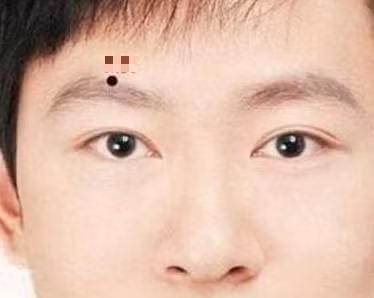 Đàn ông có nốt ruồi này phú quý, chớ có chê - Hình 2 Dan ong co not ruoi nay phu quy, cho co che-Hinh-2