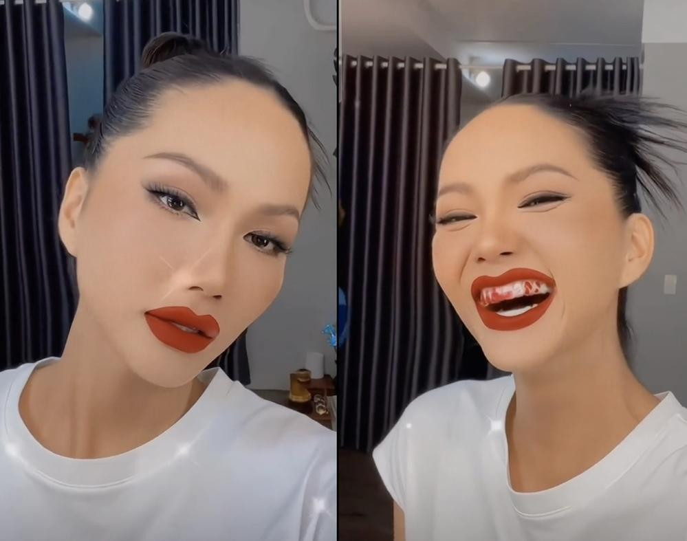 Hoang Oanh mat diem vi ham rang lem nhem-Hinh-5