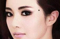 Nguoi co nhung “not ruoi may man” nay tren co the se tot