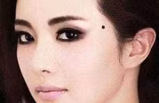 Nguoi co nhung “not ruoi may man” nay tren co the se tot