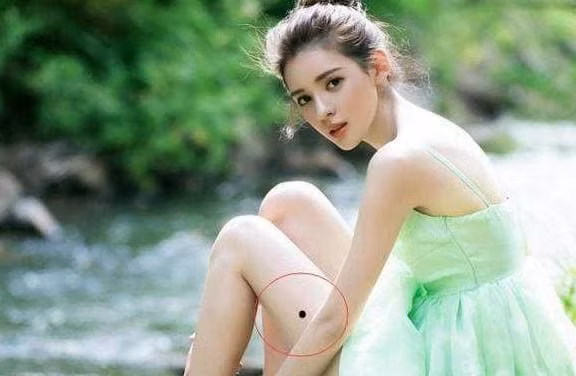 Nguoi co nhung “not ruoi may man” nay tren co the se tot-Hinh-2