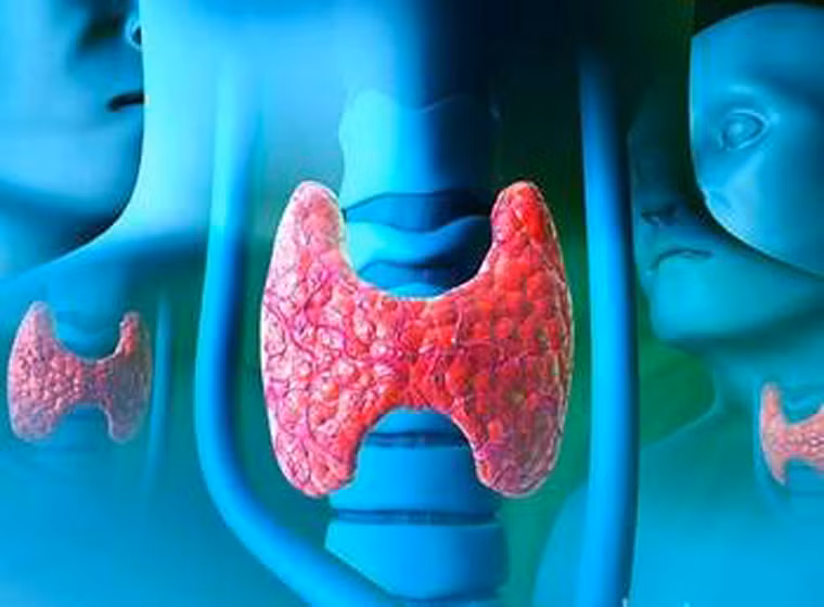 Thay đổi trong tuyến giáp: xạ trị có thể gây ảnh hưởng gây tăng hoặc giảm lượng horome được tiết ra. Nếu tuyến giáp không tạo đủ hormone, cơ thể sẽ cảm thấy mệt mỏi, làn da và tóc sẽ “xuống dốc” thảm hại. Khi dấu hiệu này xảy ra, bạn cần tiến hành xét nghiệm máu để kiểm tra nồng độ hormone. Nếu quá thấp, hãy sử dụng thuốc để kích thích tiết hormone.