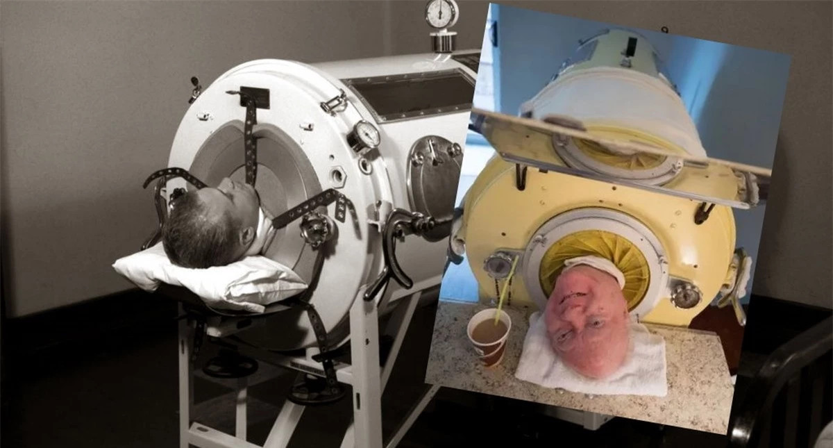 Người đàn ông sống trong 'lá phổi sắt' lâu nhất lịch sử ảnh 1 Người đàn ông sống trong 'lá phổi sắt' lâu nhất lịch sử ảnh 1