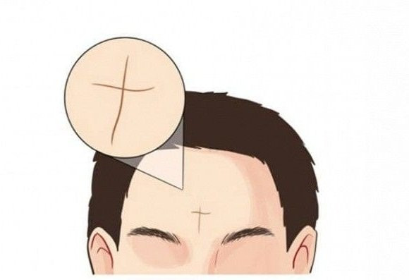 Bỏ 3 giây soi nếp nhăn trên trán biết ngay ai hưởng số giàu sang - Hình 3 Bo 3 giay soi nep nhan tren tran biet ngay ai huong so giau sang-Hinh-3