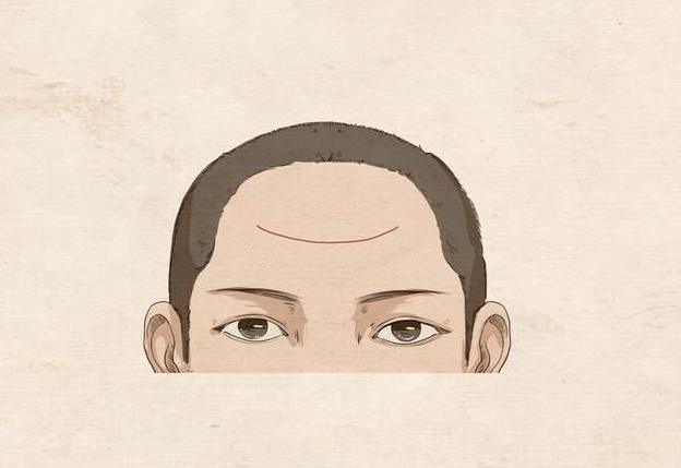 Bỏ 3 giây soi nếp nhăn trên trán biết ngay ai hưởng số giàu sang Bo 3 giay soi nep nhan tren tran biet ngay ai huong so giau sang