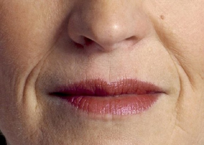 Những người này thường gặp khó khăn trong công việc và tình duyên nên họ hay cô đơn, buồn bã và sống lủi thủi một mình. Những người có tướng miệng xệ cũng thường là người không dễ tạo thiện cảm nên họ thường bị đồng nghiệp xa lánh, ít có sự giúp đỡ trong cuộc sống vì vậy cuộc sống thường gặp nhiều khó khăn. *Thông tin mang tính chất tham khảo.