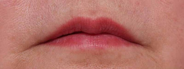  Tướng miệng xệ khiến nụ cười của bạn cũng không duyên dáng. Những người miệng xệ là những người mà tương lai khó có thể làm lớn và hay gặp vận xui rủi.