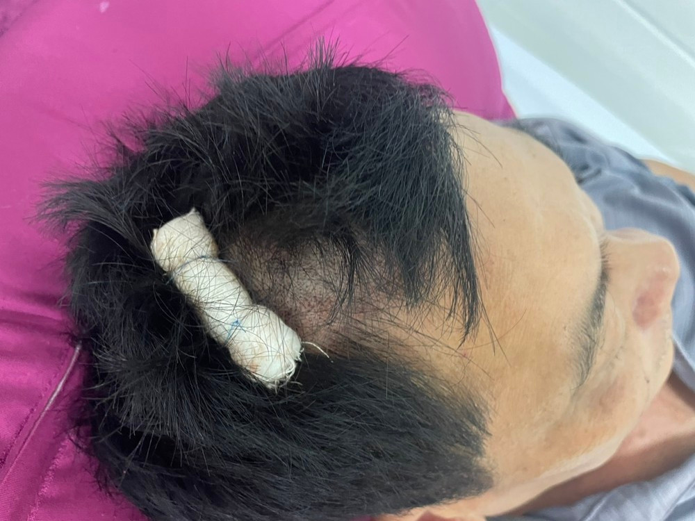 Cán bộ xã dùng cốc đập vào đầu người dân trong quán nhậu - Hình 2 Can bo xa dung coc dap vao dau nguoi dan trong quan nhau-Hinh-2