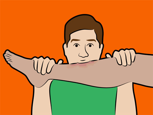 Mẹo 1: Bạn có thể hút nọc độc ra khi bị rắn cắn Thực tế: Nếu một vết cắn mang nọc độc, độc tố sẽ ngay lập tức xâm nhập vào máu. Đưa miệng của bạn lên trên vết cắn sẽ chỉ làm cung cấp thêm các vi khuẩn xâm nhập vào vết thương. Sau đó, nọc độc từ vết cắn sẽ chảy ngược lại vào miệng và thực quản của bạn. Nếu một người bị rắn cắn, trong khi đưa đến bệnh viện, bạn hãy giữ cho họ có nhịp tim càng thấp càng tốt và vết cắn nằm thấp hơn so với tim.