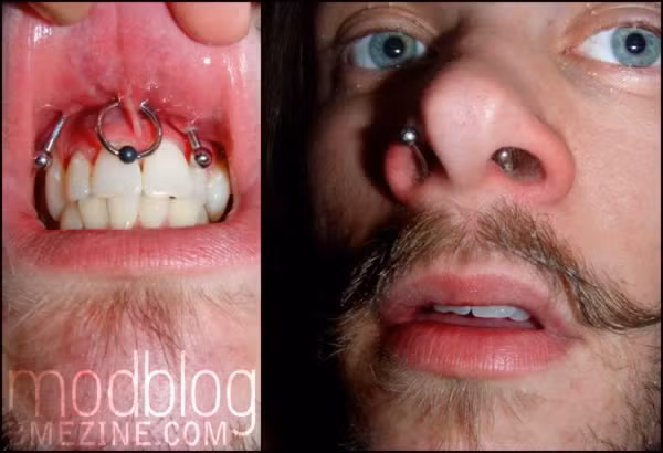 Một kiểu xỏ khuyên kinh dị xuyên từ mũi xuống miệng.