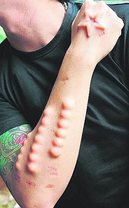 Ngôi sao và những viên bi trên cánh tay.