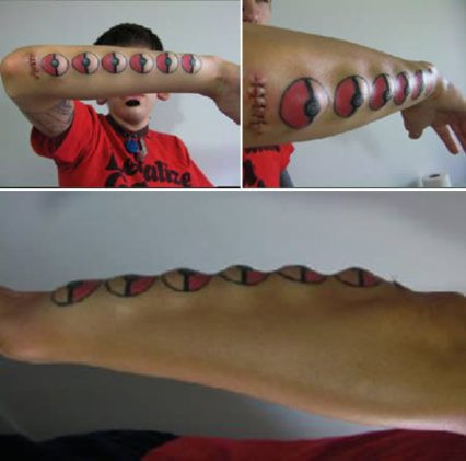 Anh chàng này còn chịu chơi đến mức cấy 6 quả bóng thẳng hàng dưới một cánh tay.