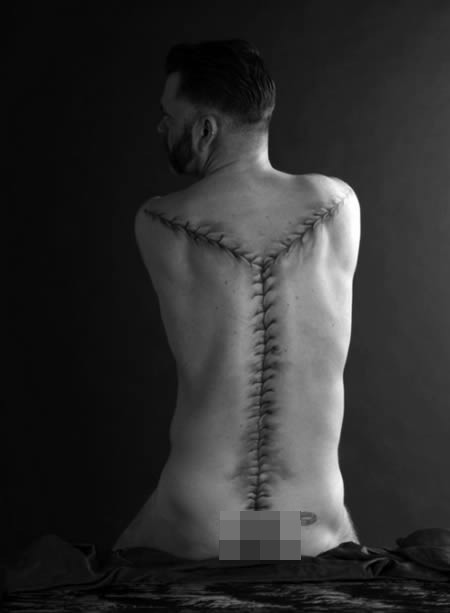 Anh Richard Sawdonsmith táo bạo với hình xăm vết khâu giải phẫu này.