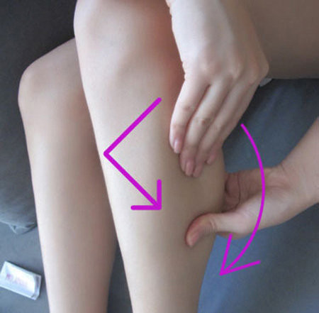 Phẫu thuật được thực hiện với hai đường rạch da: Một đường rạch khoảng 5 cm ở mặt sau nhượng chân để lấy toàn bộ bó trong của cơ sinh đôi. Có thể lấy luôn toàn bộ bó ngoài cơ sinh đôi nếu cần. Một đường rạch da ở giữa mặt sau bắp chân để lấy đầu dưới của cơ sinh đôi ra ngoài. Khuyết điểm: cơ khác của bắp chân sẽ to bù trừ giống như cắt thần kinh chọn lọc.