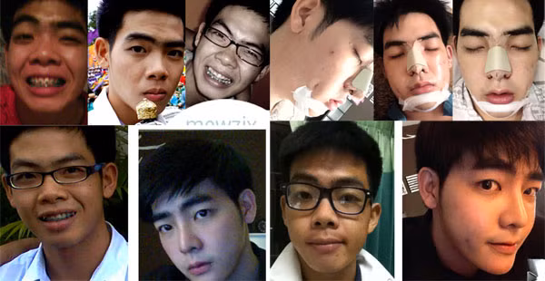 Hành trình dao kéo của hotboy người Thái được mô tả qua những bức ảnh ghép đăng tải trên trang mạng Istargram của chính cậu ta.