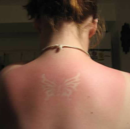 Người phụ nữ này cho rằng hình xăm cháy nắng hình cánh bướm này có thể khiến cô ta quyến rũ hơn.