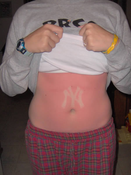 Dòng chữ viết tắt của thành phố New York trên bụng cô gái người Mỹ.