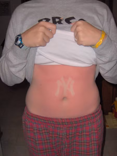 Dòng chữ viết tắt của thành phố New York trên bụng cô gái người Mỹ.